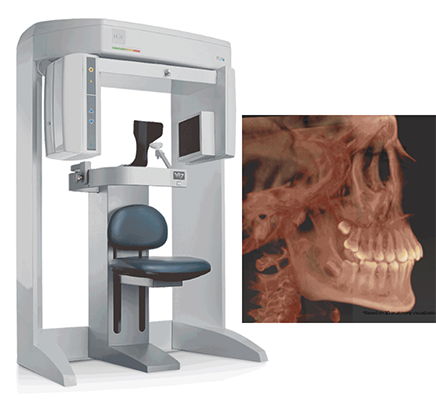 ICAT CBCT