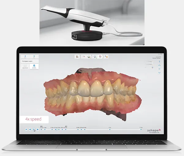 intraoral scan example