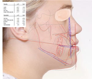 computerized simulation