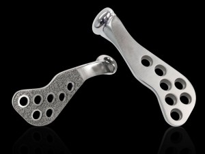 Two TMJ implants